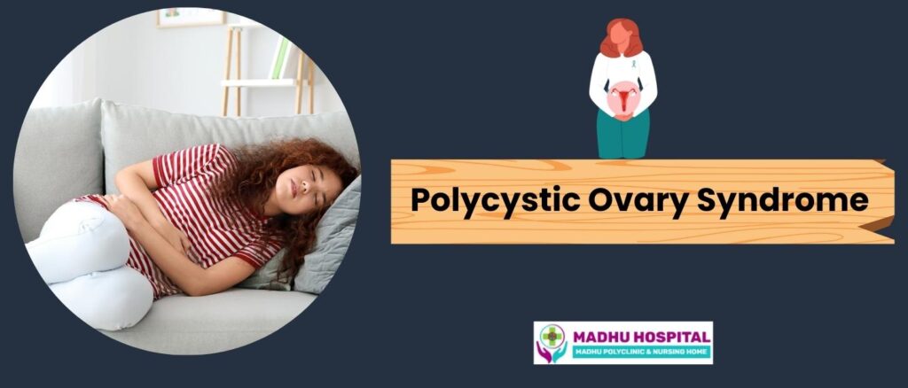 Understanding Polycystic Ovary Syndrome (PCOS) | Dr Sachin Dalal